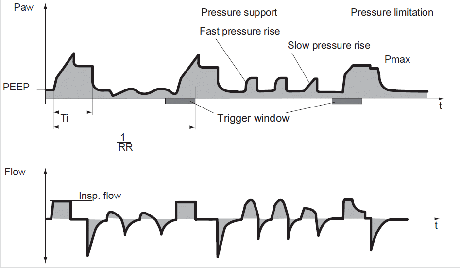 Mode dan Setting Dasar Ventilator