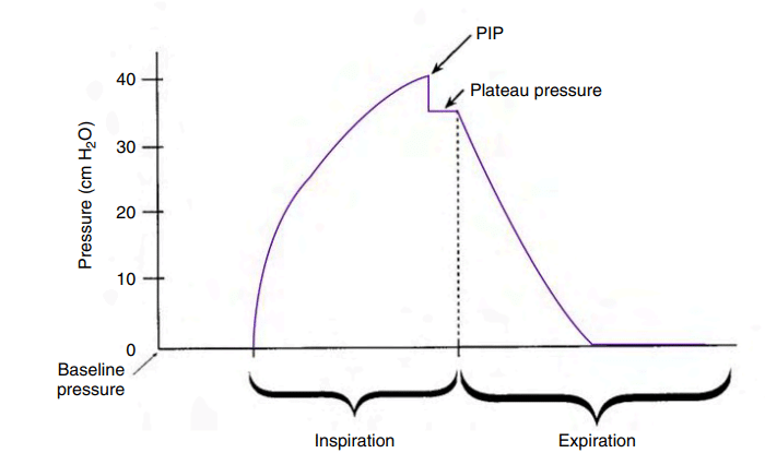 pernafasan tanpa PEEP